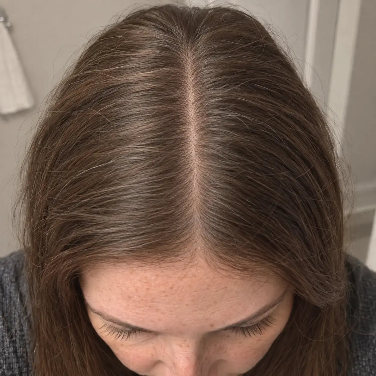 After view in the comparison