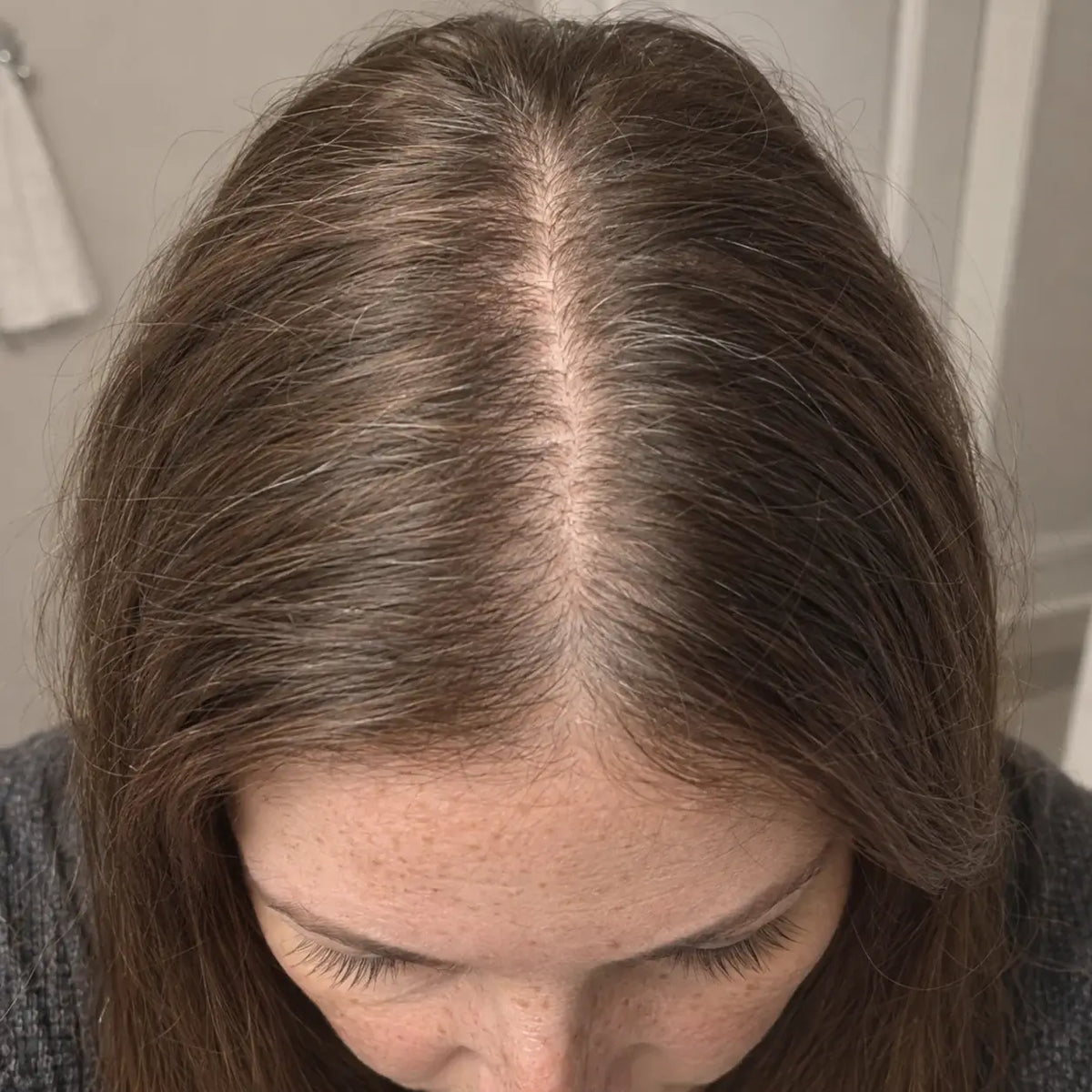 Before view in the comparison